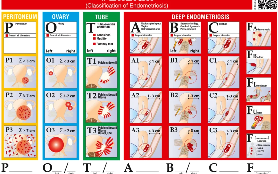 Engrosamiento del endometrio es peligroso